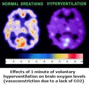 brain-oxygen-effects-hypocapnia-hyperventilation
